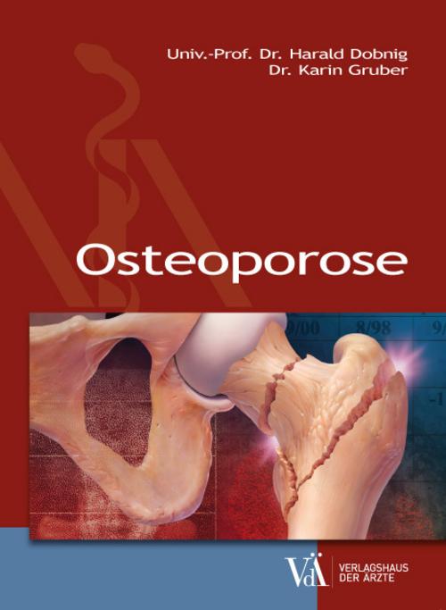 Buchcover: Osteoporose