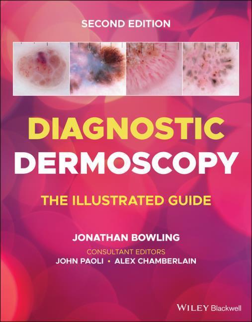 Buchcover: Diagnostic Dermoscopy