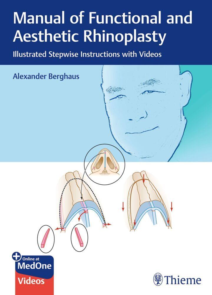 Buchcover: Manual of Functional and Aesthetic Rhinoplasty