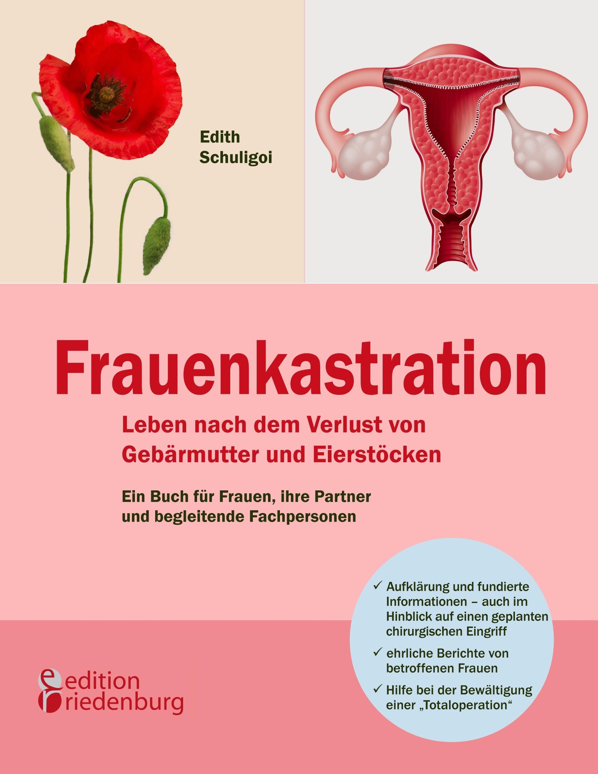 Buchcover: Frauenkastration - Leben nach dem Verlust von Gebärmutter und Eierstöcken: Ein Buch für Frauen, ihre Partner und begleitende Fachpersonen