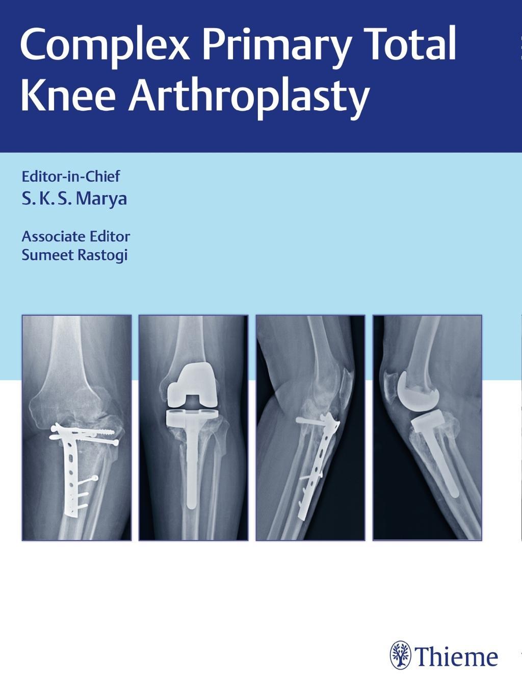 Buchcover: Complex Primary Total Knee Arthroplasty