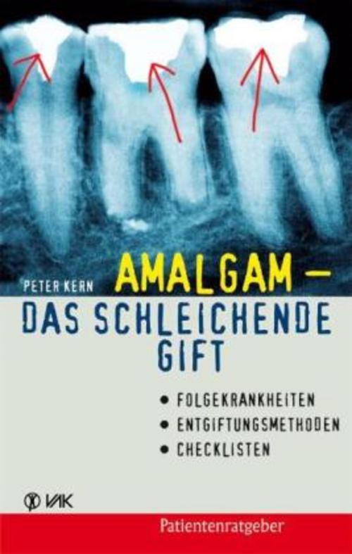 Buchcover: Amalgam - das schleichende Gift