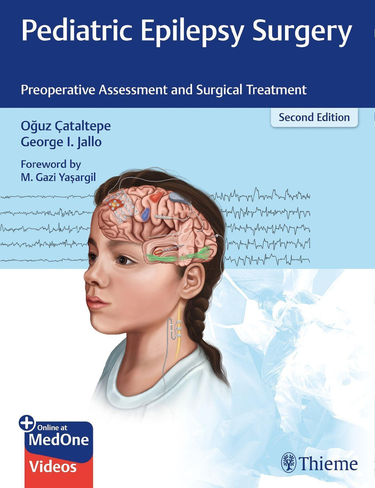 Buchcover: Pediatric Epilepsy Surgery