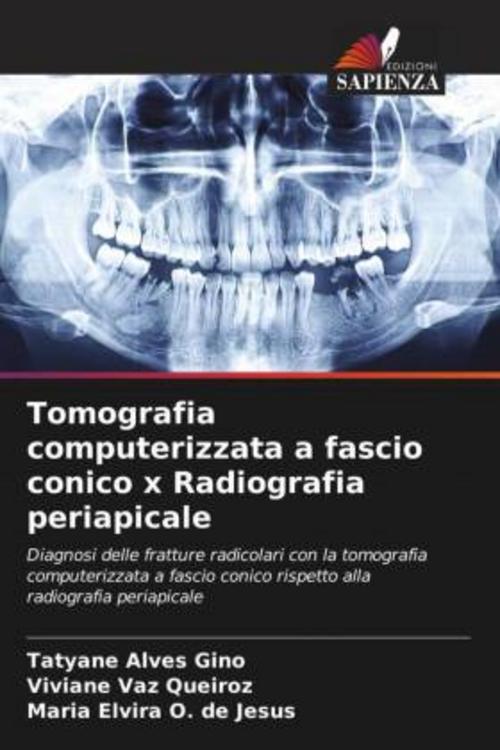 Buchcover: Tomografia computerizzata a fascio conico x Radiografia periapicale