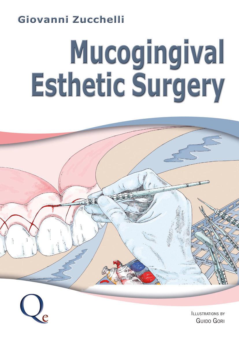 Mucogingival Esthetic Surgery