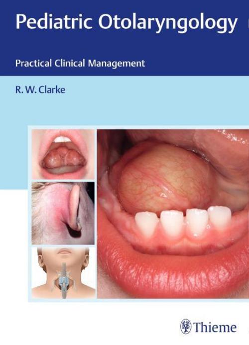 Buchcover: Pediatric Otolaryngology