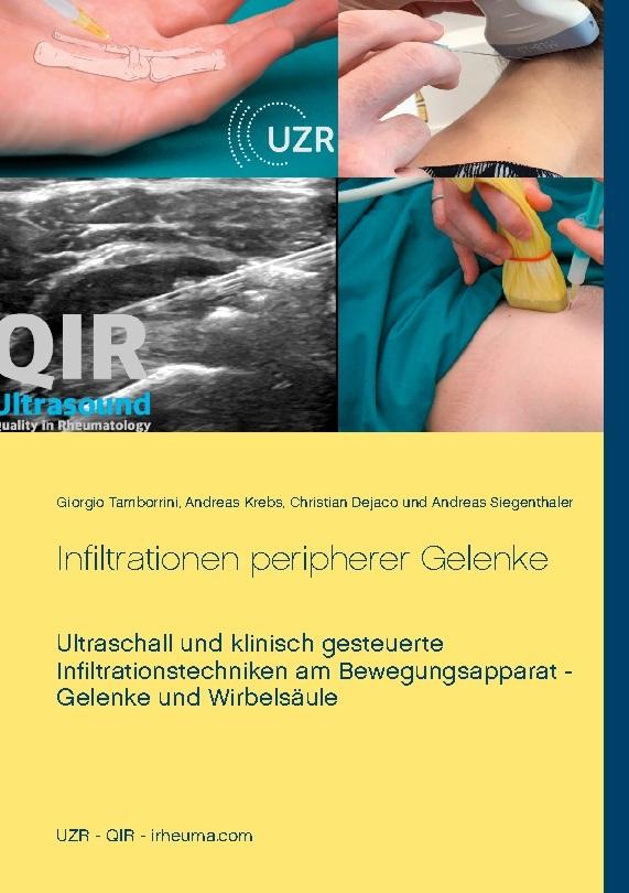 Infiltrationen peripherer Gelenke