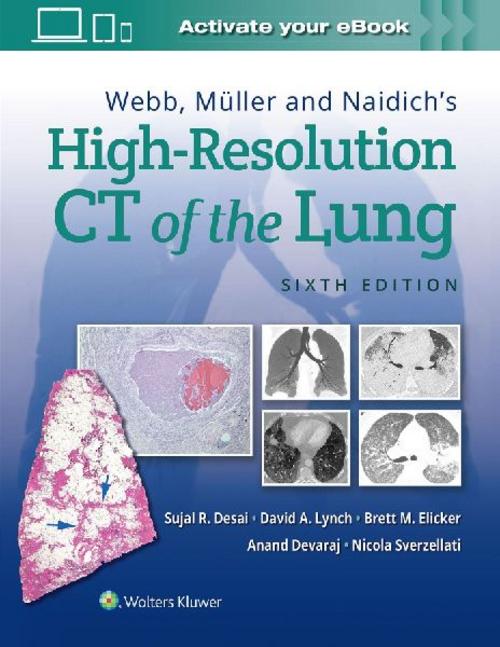 Buchcover: Webb, Muller and Naidich's High Resolution of Lung CT