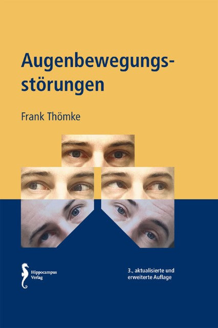 Augenbewegungsstörungen