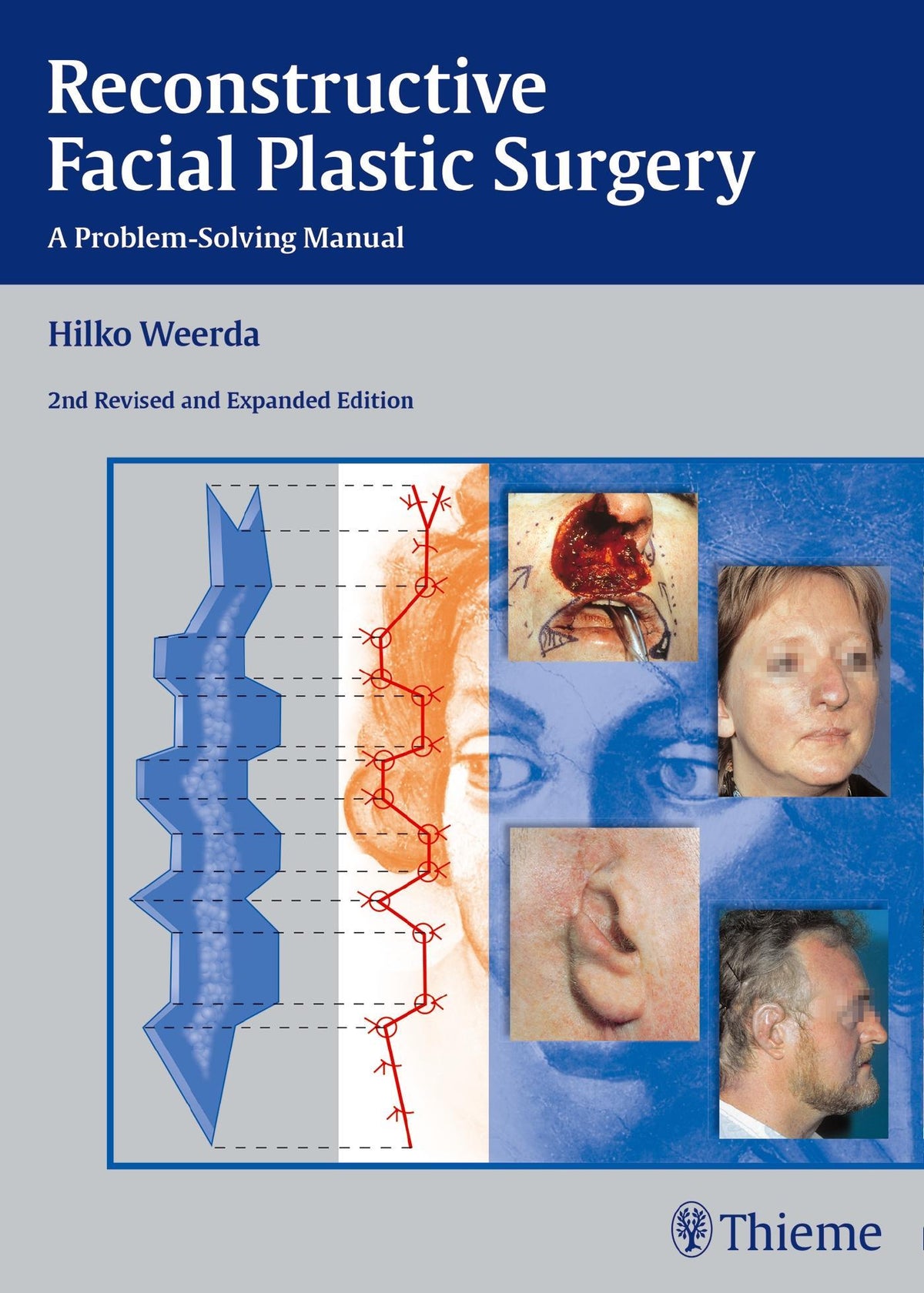 Buchcover: Reconstructive Facial Plastic Surgery