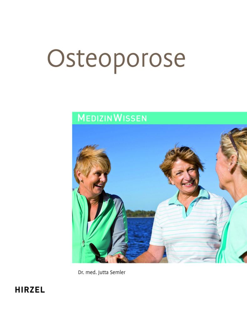 Buchcover: Osteoporose
