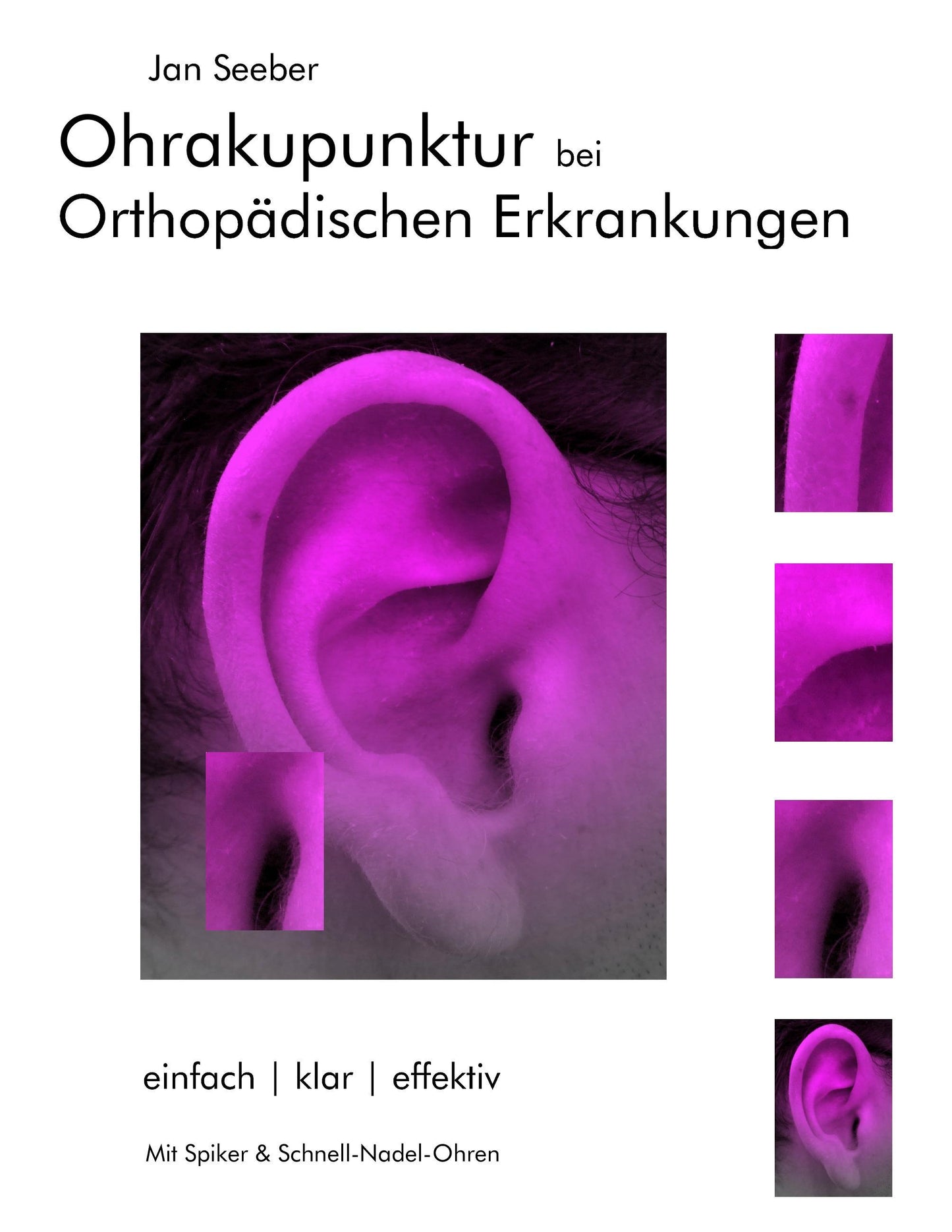 Ohrakupunktur bei Orthopädischen Erkrankungen