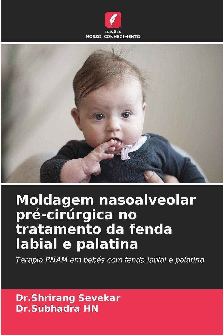 Buchcover: Moldagem nasoalveolar pré-cirúrgica no tratamento da fenda labial e palatina