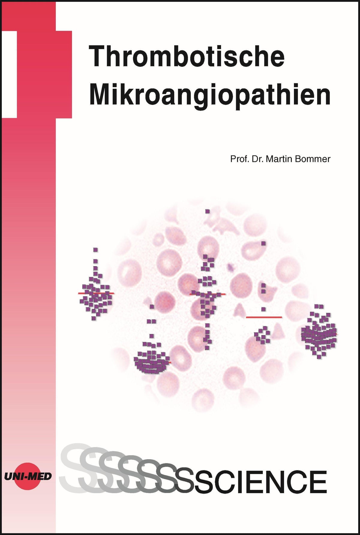 Buchcover: Thrombotische Mikroangiopathien