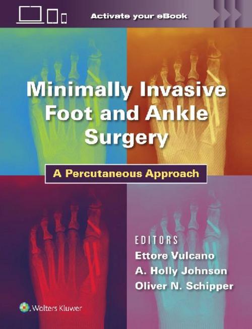 Buchcover: Minimally Invasive Foot and Ankle Surgery