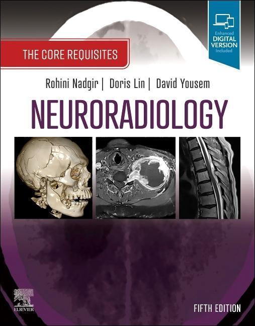 Buchcover: Neuroradiology