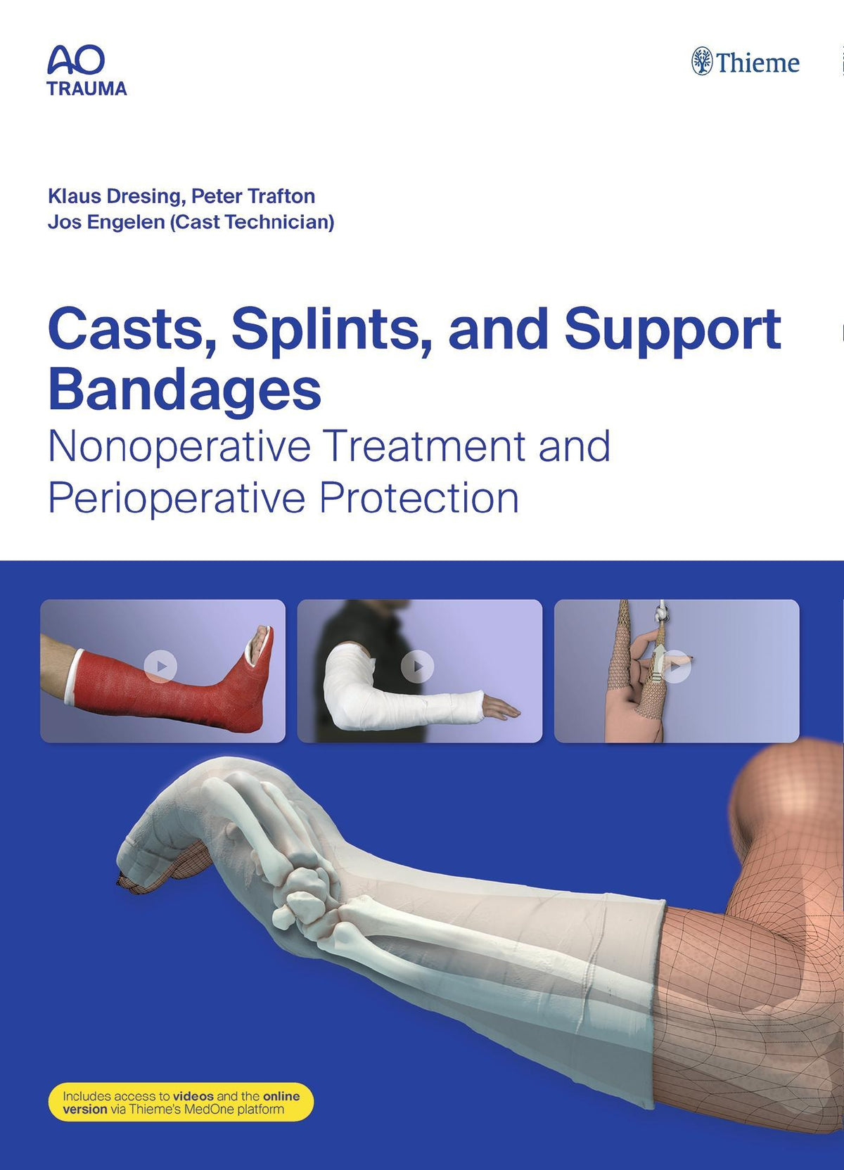 Buchcover: Casts, Splints, and Support Bandages