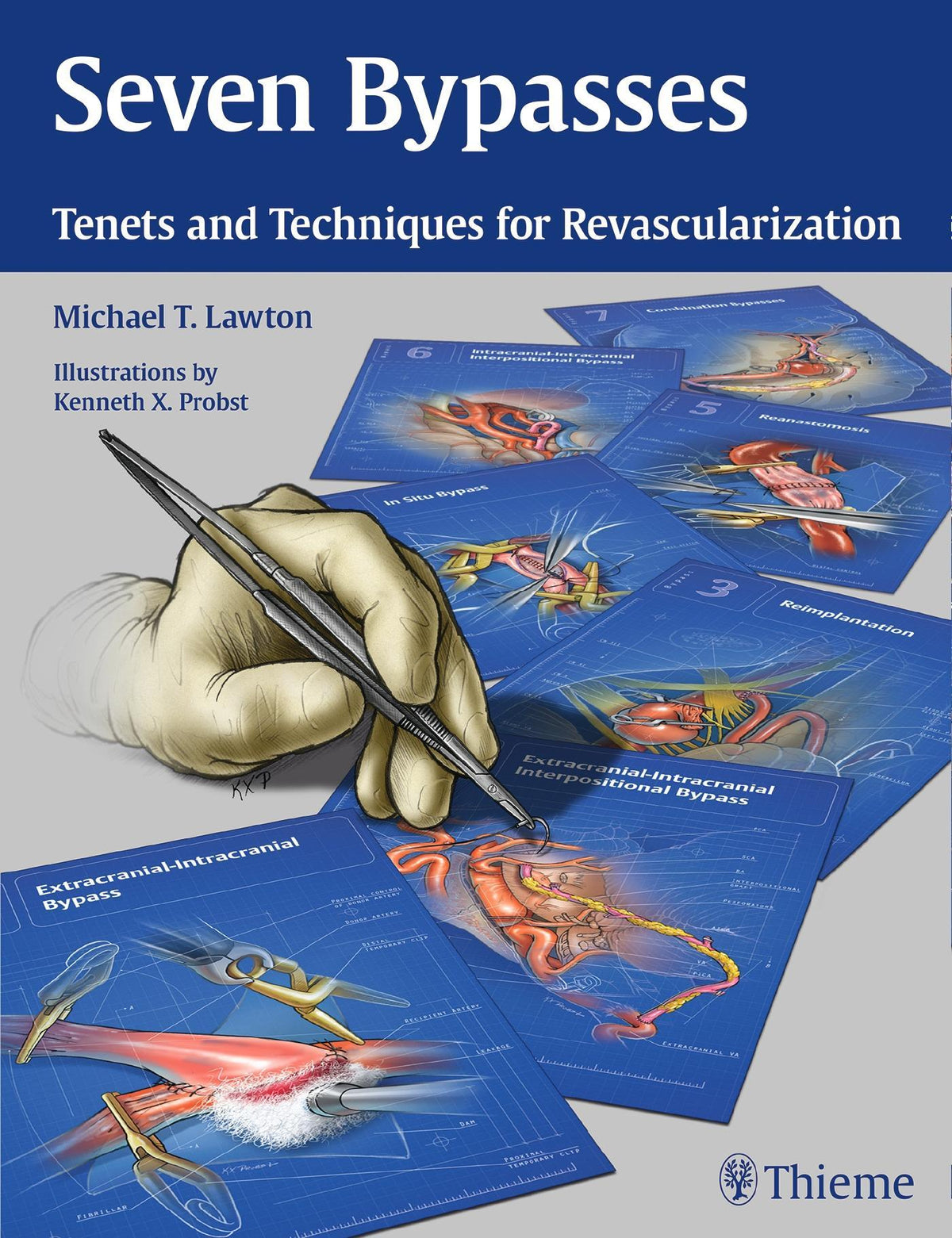 Buchcover: Seven Bypasses