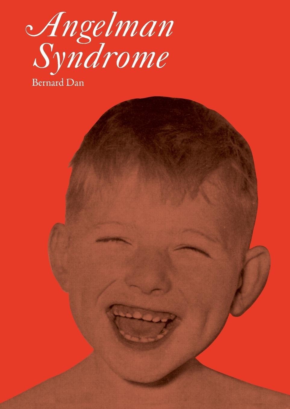 Buchcover: Angelman Syndrome