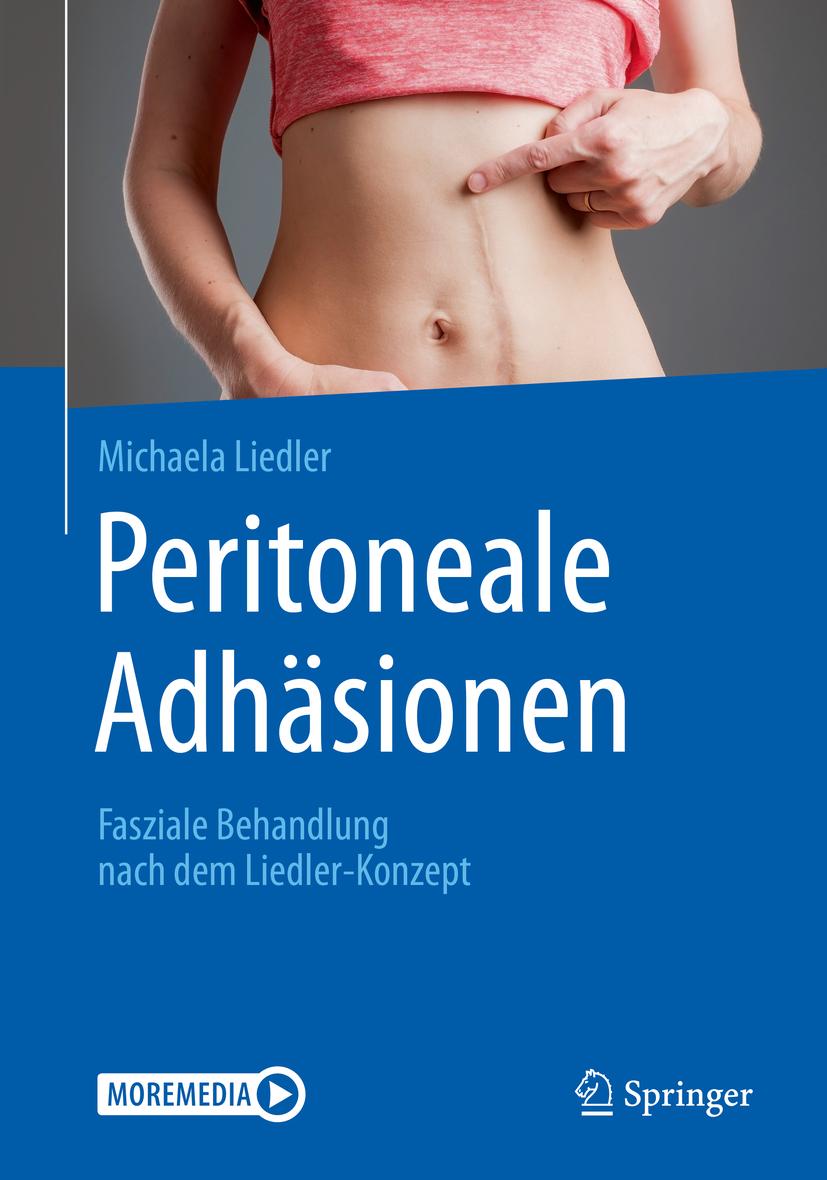 Buchcover: Peritoneale Adhäsionen