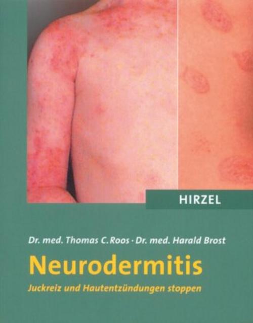 Buchcover: Neurodermitis