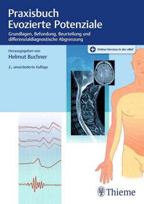 Praxisbuch Evozierte Potenziale: Grundlagen, Befundung, Beurteilung und differenzialdiagnostische Abgrenzung