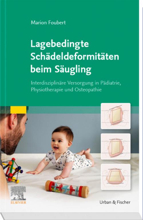 Lagebedingte Schädeldeformitäten beim Säugling
