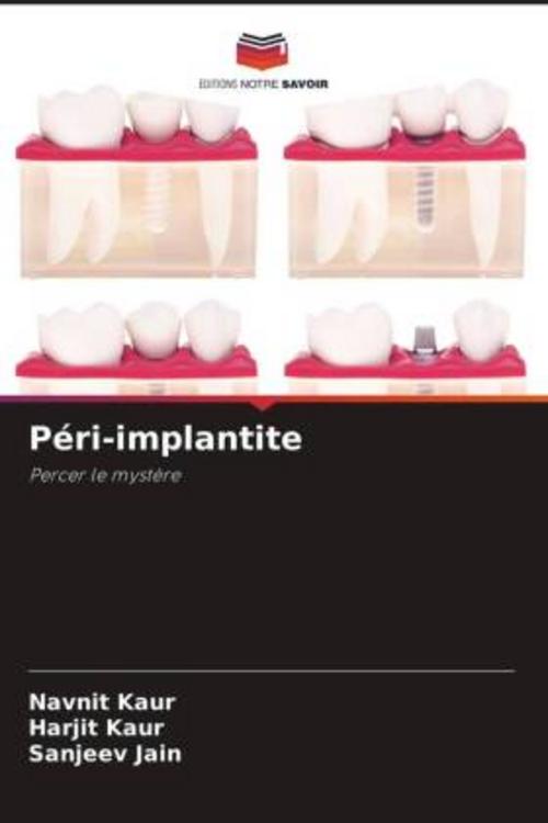 Buchcover: Péri-implantite