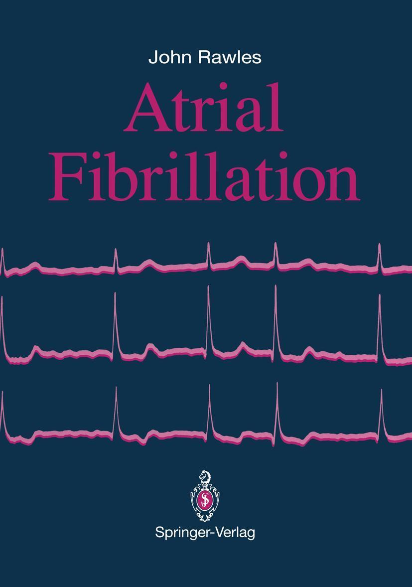 Buchcover: Atrial Fibrillation