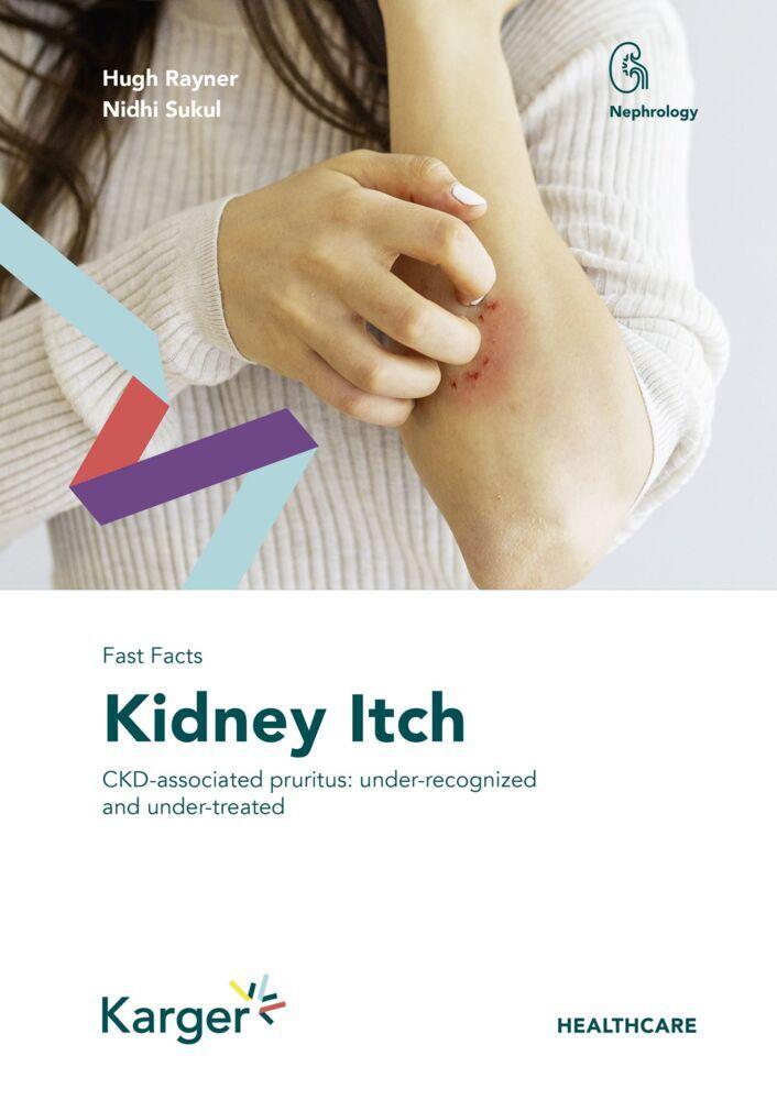 Buchcover: Fast Facts: Kidney Itch