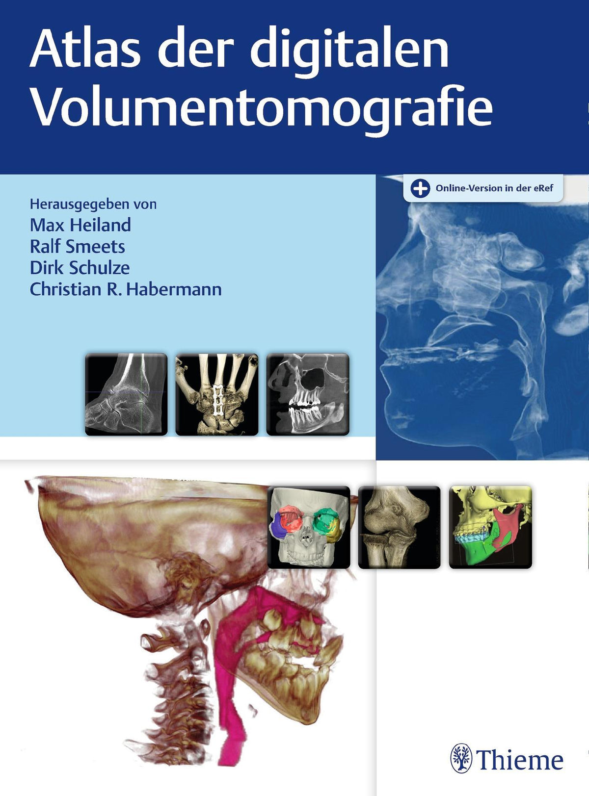 Buchcover: Atlas der digitalen Volumentomografie