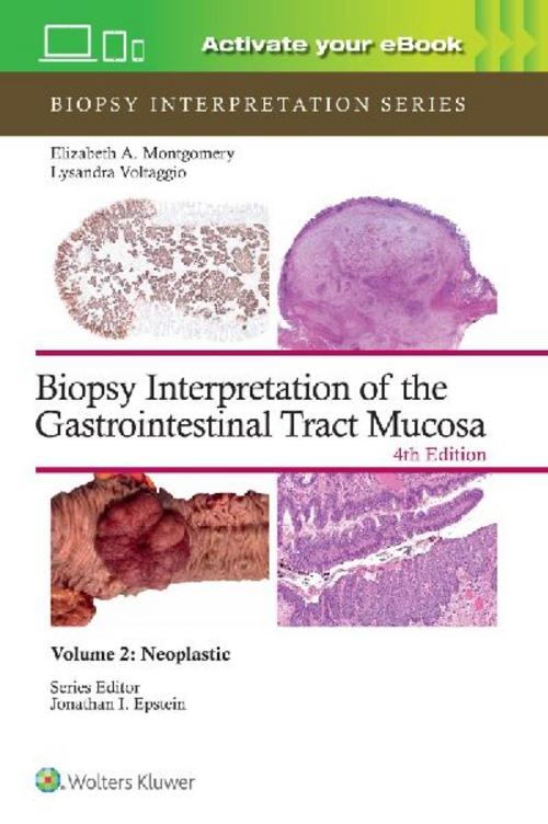 Buchcover: Biopsy Interpretation of the Gastrointestinal Tract Mucosa Volume 2
