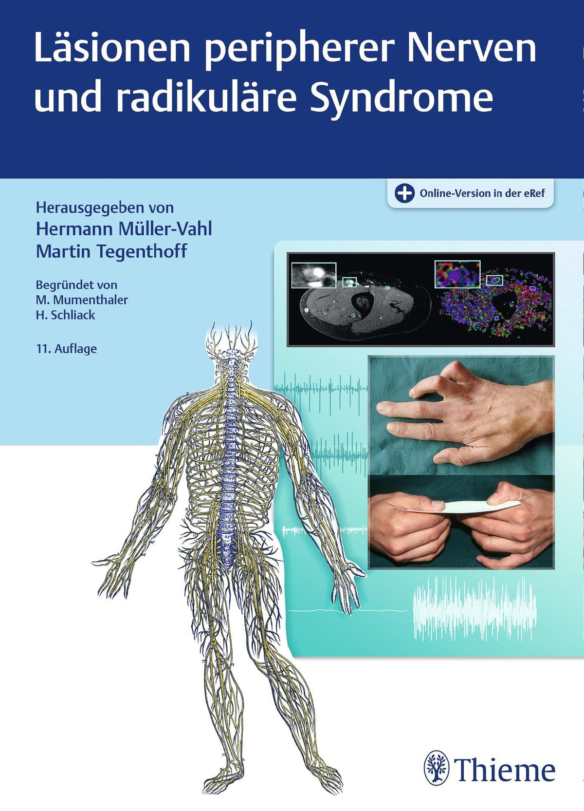 Buchcover: Läsionen peripherer Nerven und radikuläre Syndrome