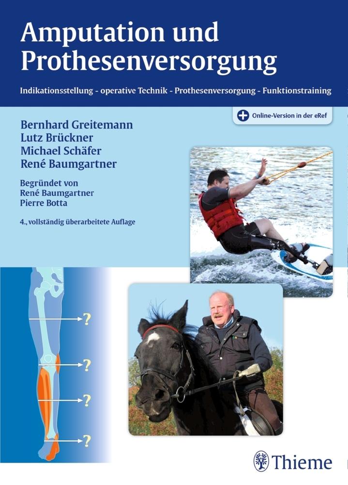 Buchcover: Amputation und Prothesenversorgung
