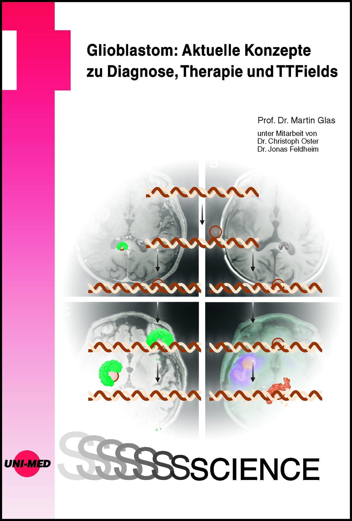 Buchcover: Glioblastom: Aktuelle Konzepte zu Diagnose, Therapie und TTFields