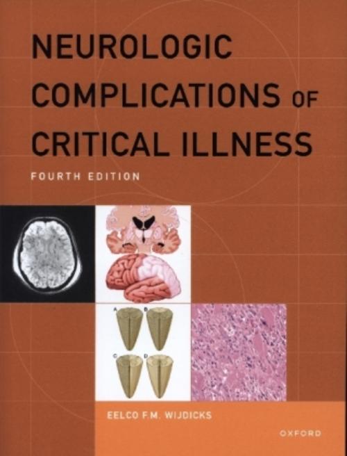 Buchcover: Neurologic Complications of Critical Illness