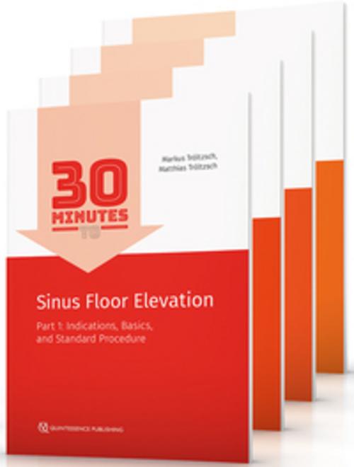 30 Minutes to Augmentation - Set 1