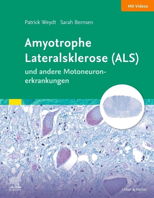 Buchcover: Amyotrophe Lateralsklerose (ALS) und andere Motoneuronerkrankungen