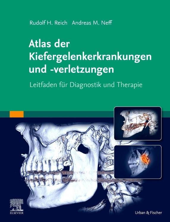 Buchcover: Atlas der Kiefergelenkerkrankungen und -verletzungen