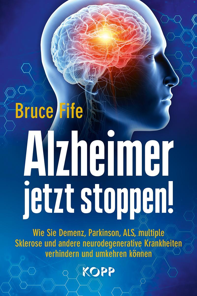 Buchcover: Alzheimer jetzt stoppen!