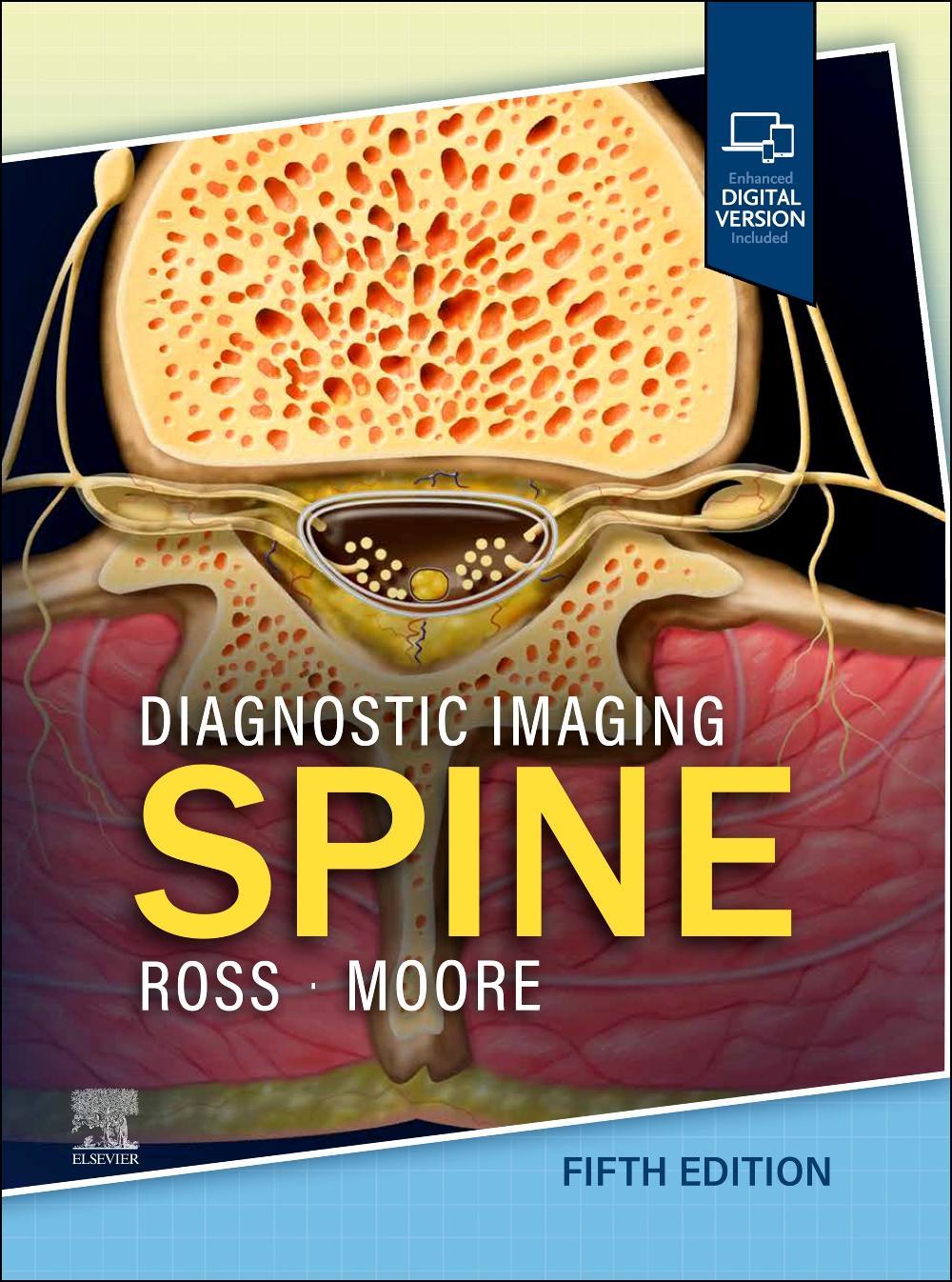 Buchcover: Diagnostic Imaging: Spine