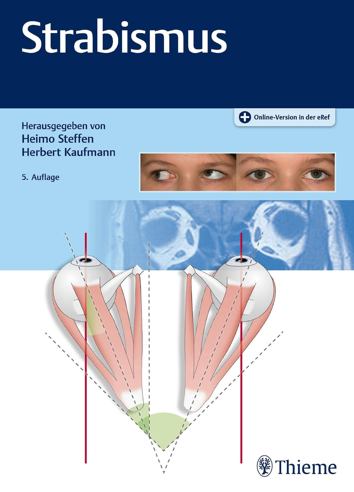 Buchcover: Strabismus