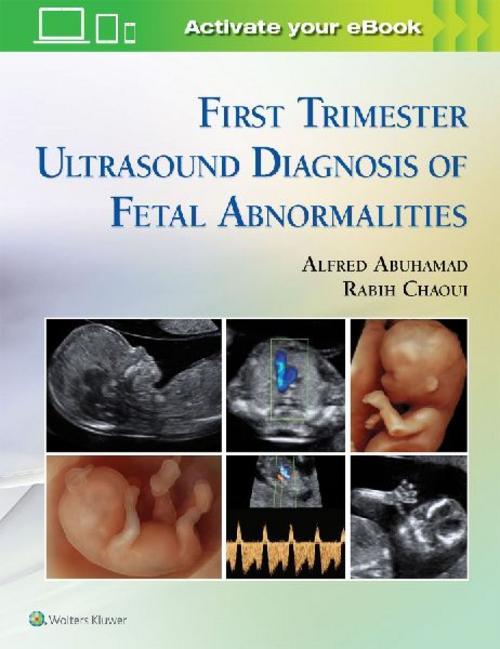 Buchcover: First Trimester Ultrasound Diagnosis of Fetal Abnormalities