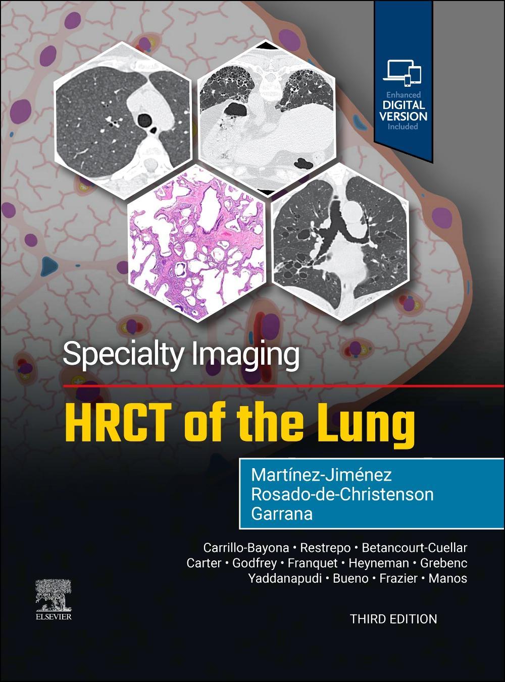 Buchcover: Specialty Imaging: HRCT of the Lung