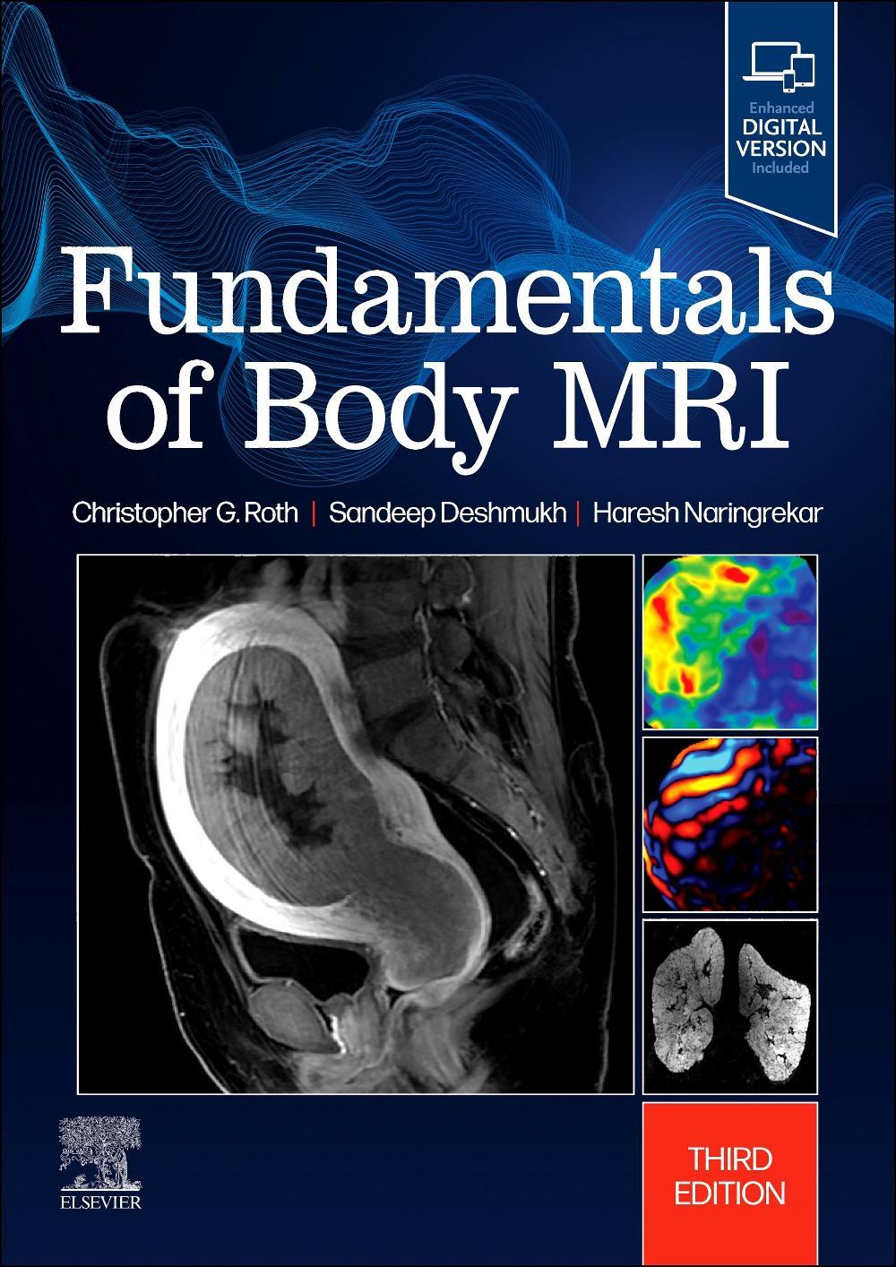 Buchcover: Fundamentals of Body MRI