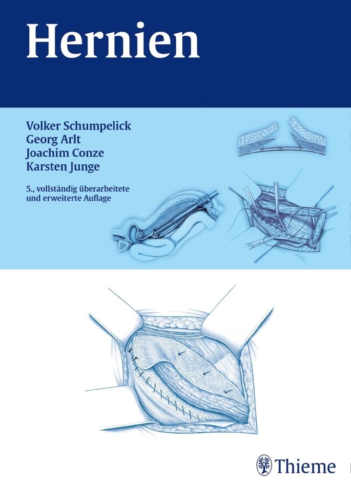 Buchcover: Hernien