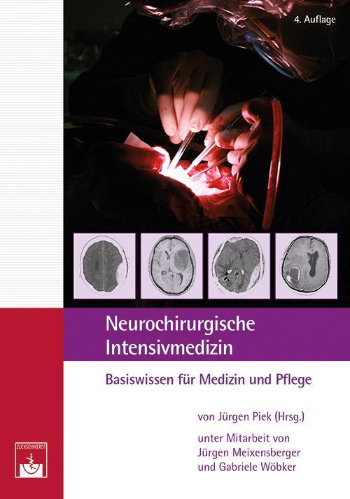 Buchcover: Neurochirurgische Intensivmedizin