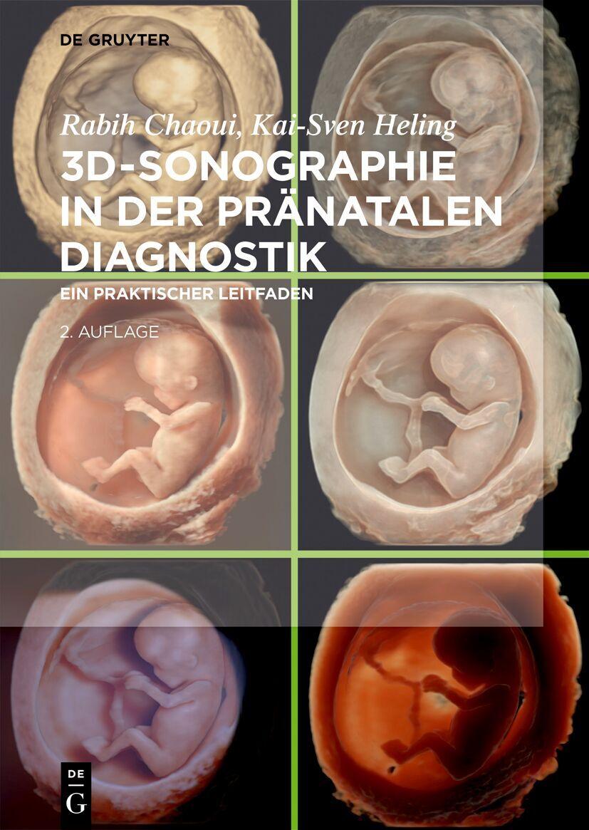 Buchcover: 3D-Sonographie in der pränatalen Diagnostik