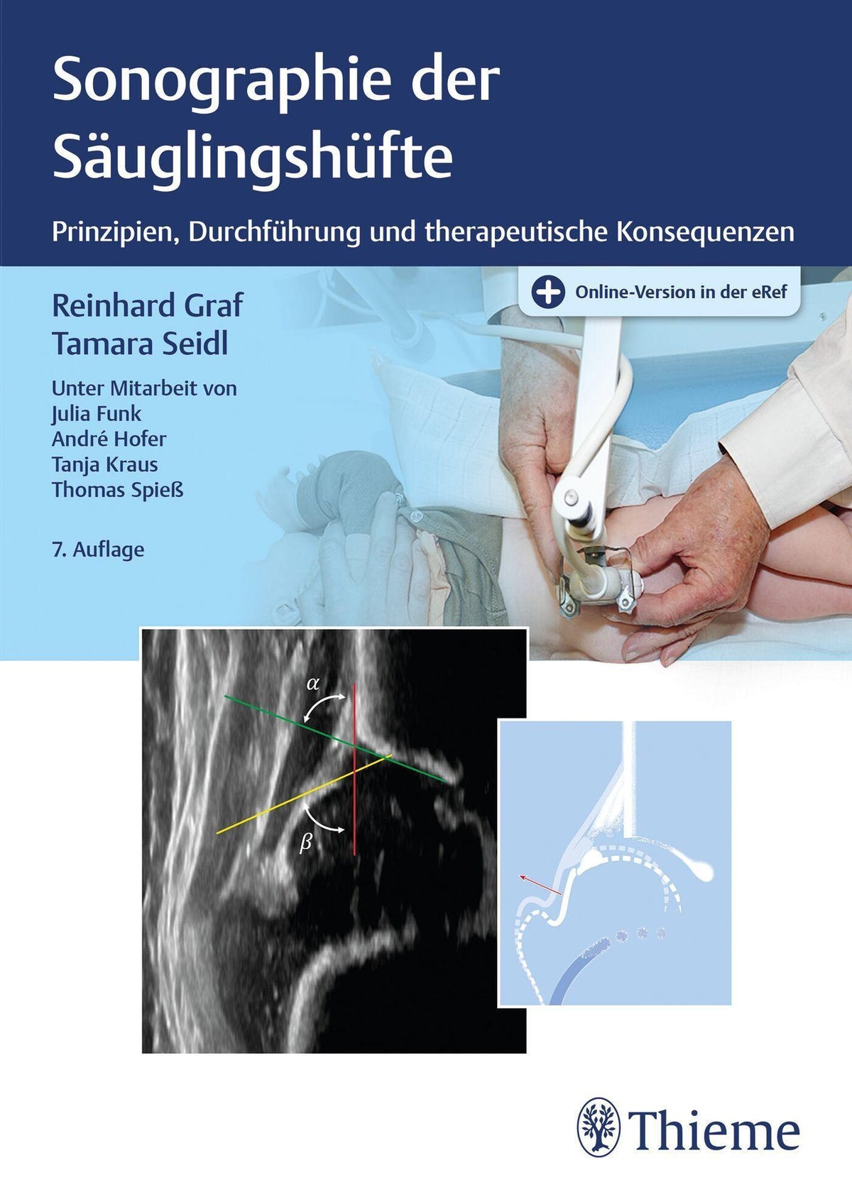 Buchcover: Sonographie der Säuglingshüfte