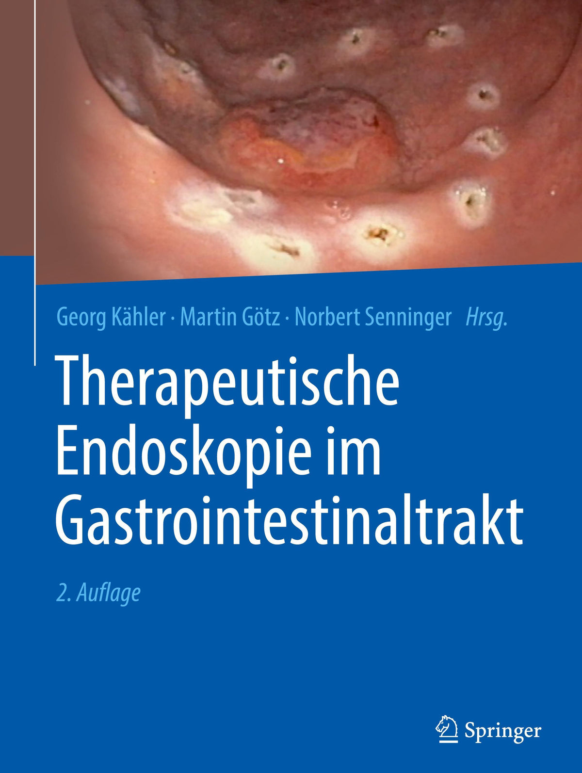 Buchcover: Therapeutische Endoskopie im Gastrointestinaltrakt